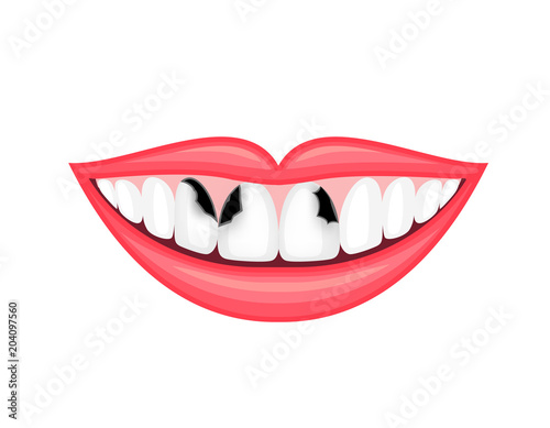 Tooth decay, unhealthy teeth. Human mouth, dental care concept. Illustration isolated on white background.