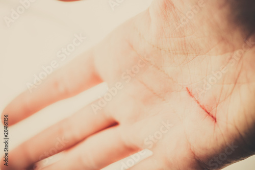 Woman palm with a cut scratch on a destiny line photo