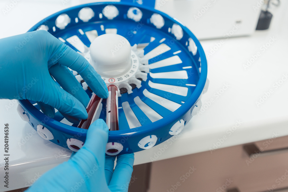 Doctor mounting blood tubes on spin wheel of centrifugal analyzer Stock