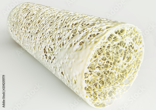 Cross section of an advanced osteoporosis -high details - Stage 4 - 3d rendering