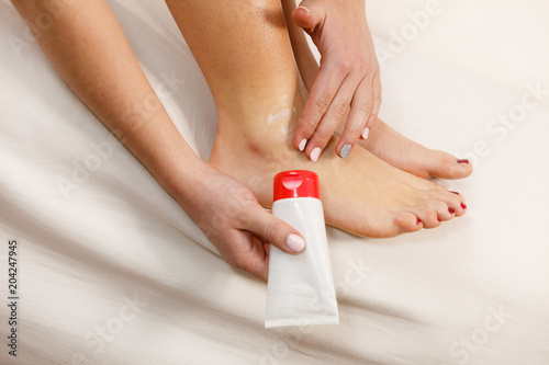 Woman putting ointment on bad ankle applying cream