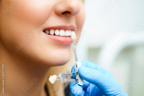 Beautiful smile and white teeth of a young woman. Matching the shades of the implants or the process of teeth whitening.