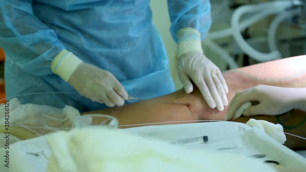 Process of liposuction surgery Process of liposuction surgery