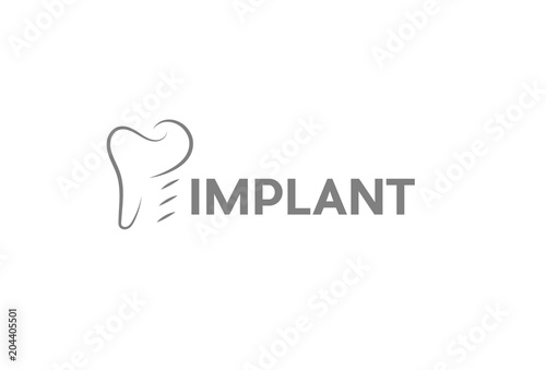 Implant logo