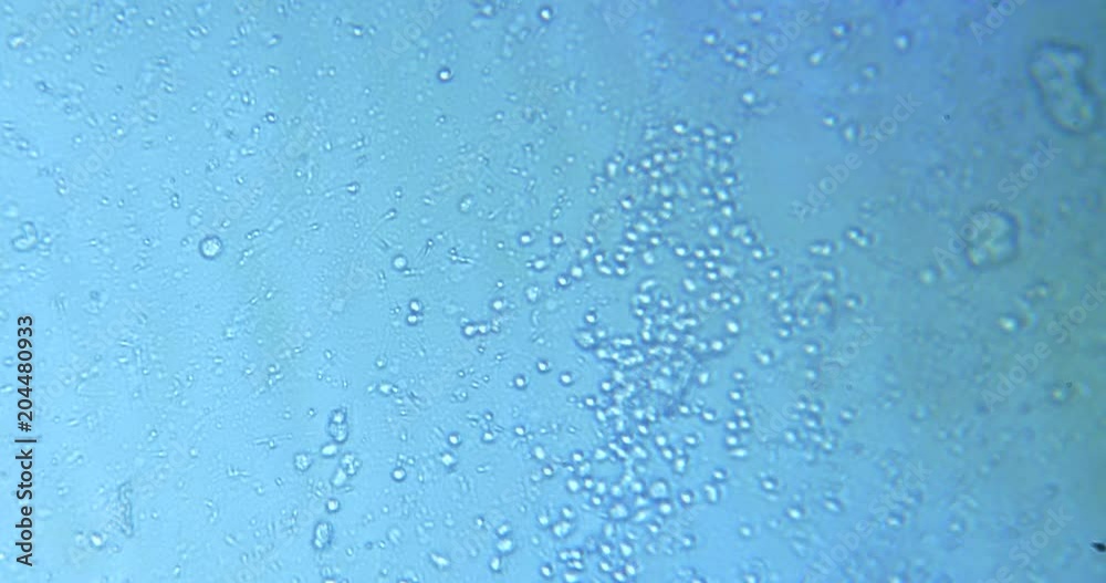 Spermatozoids under the microscope. Alive organisms. Spermatozoids under the microscope. Alive organisms.