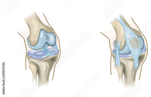 Canvas Print The knee joint, anatomy, medical illustration