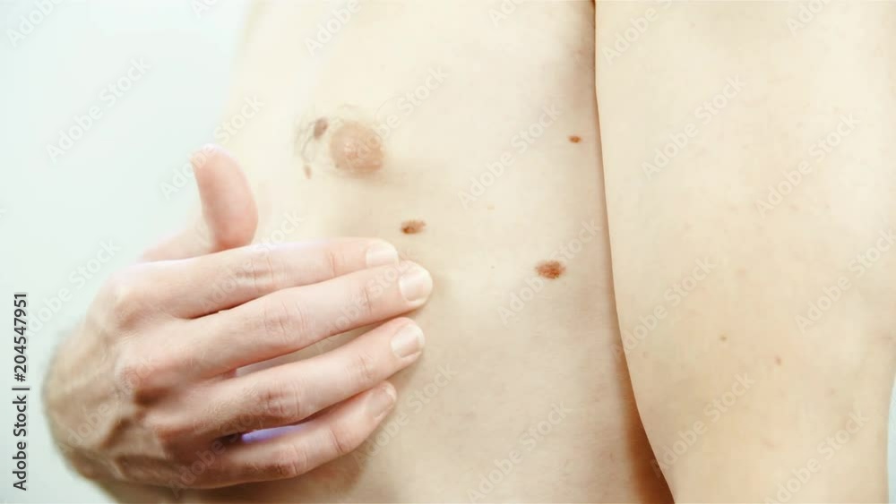 Skin moles check on male body 4K