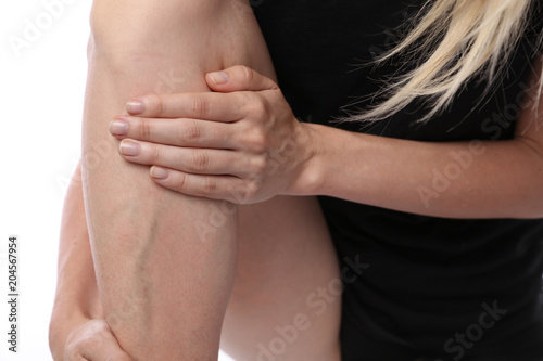 Fotografía Painful varicose and spider veins on female legs