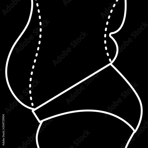 Liposuction, weight loss