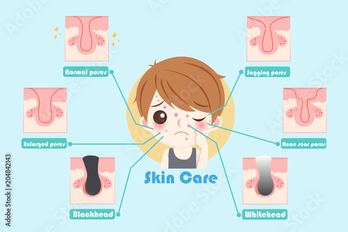 man with skin care problem