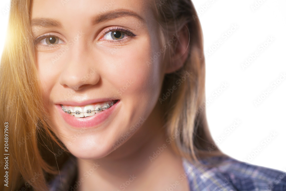 Portrait of teen girl showing dental braces. Portrait of teen girl showing dental braces.