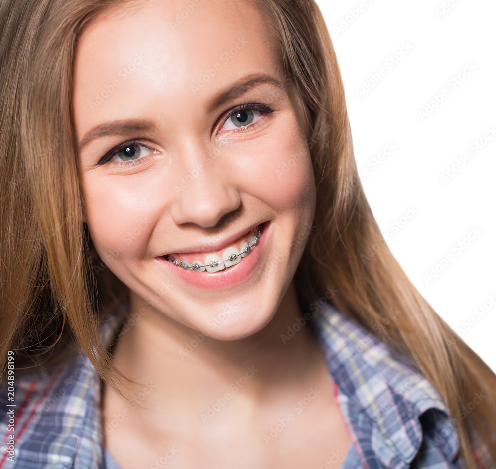 Portrait of teen girl showing dental braces. Portrait of teen girl showing dental braces.