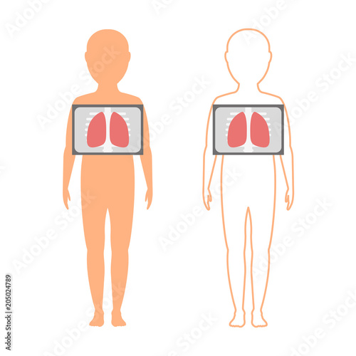 Kids fluorography. Vector illustration.
