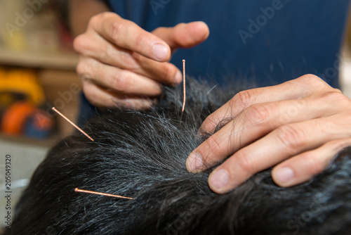 Fototapeta Naklejka Na Ścianę i Meble -  acupuncture vétérinaire emploie des aiguilles très fines, à usage unique. Le soin est indolore et ne représente pas de danger pour la santé de l'animal.