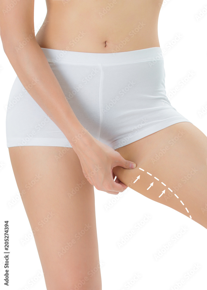 Woman grabbing skin on her Inner thigh with the drawing arrows, Lose weight and liposuction cellulite removal concept, Isolated on white background. - obrazy, fototapety, plakaty 