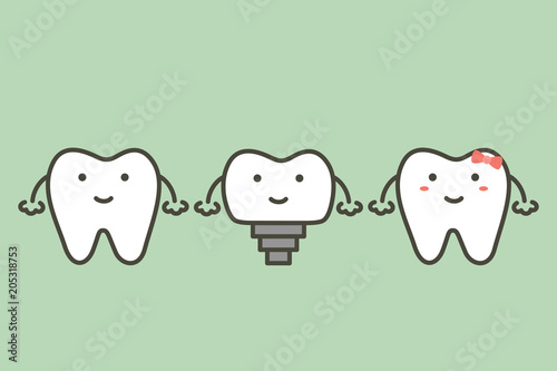 tooth implant, teeth change new root and friends