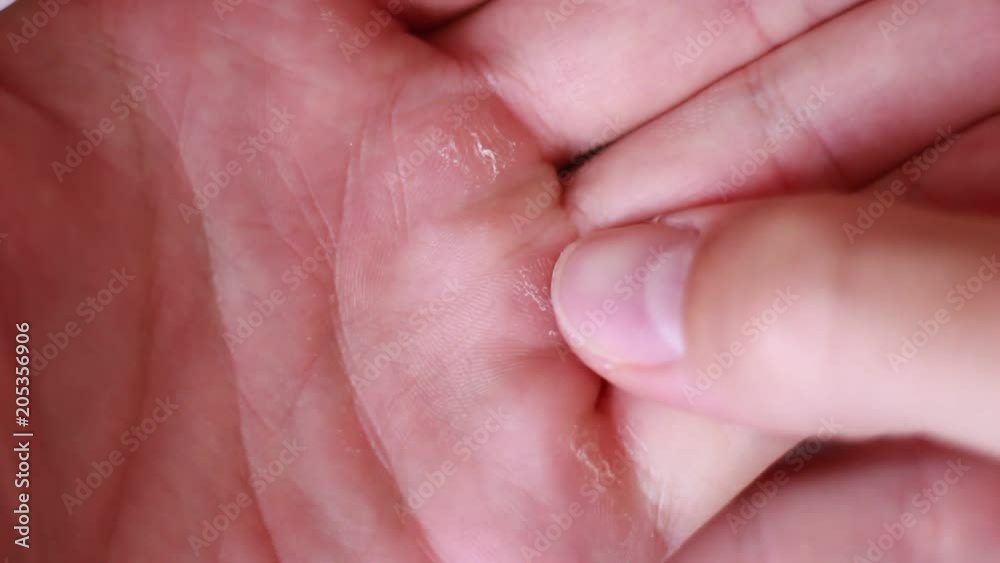 Male callous hand close up Male callous hand close up