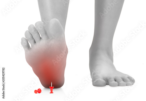 Woman stepping foot on red push pin red highlighted on pain area, unforeseen concept, black and white color, Isolated on white background.