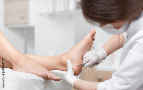 Profeesional doctor polish callus and corn on feet of client.