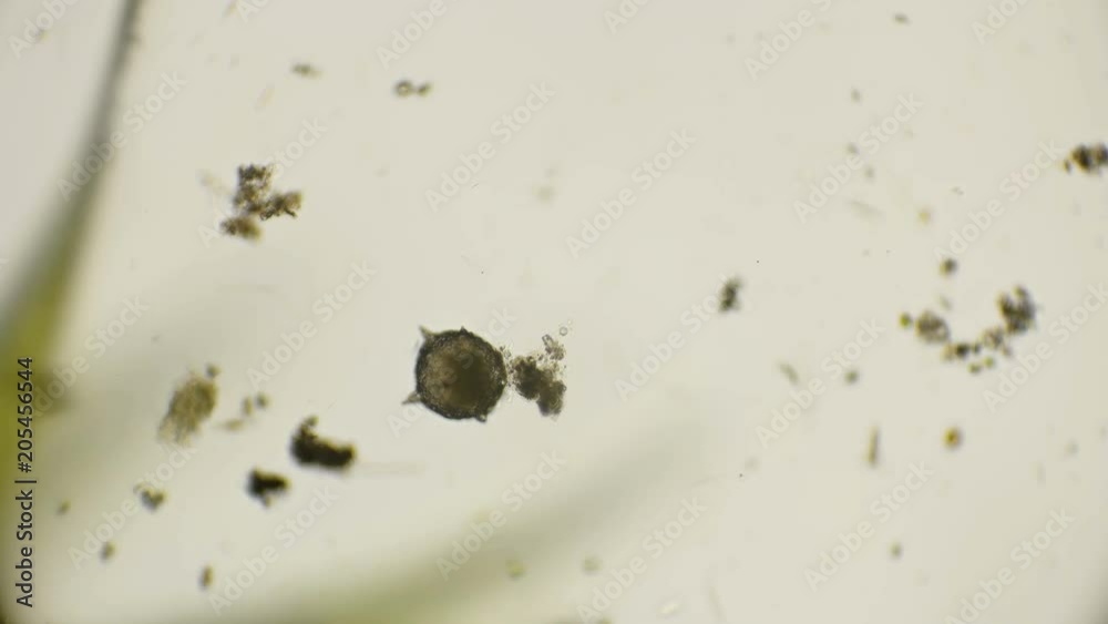 class of sarcodic microorganism under a microscope class of sarcodic microorganism under a microscope