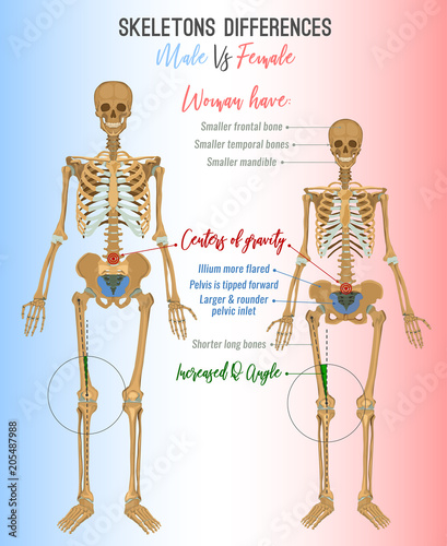 Skeleton differences image