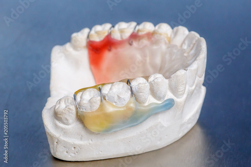 Colorful dental braces or retainer, clay human gums model