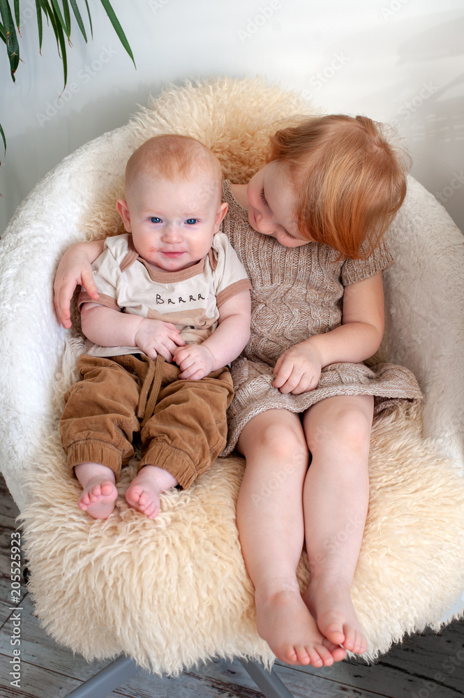 Allergies, atopic dermatitis on the face of a baby Allergies, atopic dermatitis on the face of a baby