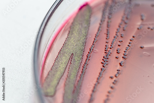 Cuadro en lienzo Colony Characteristics of Escherichia coli (E