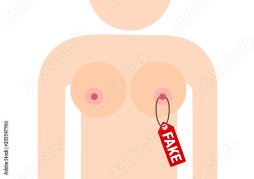 Fake and unreal big and large breast after plastic and cosmetic surgery - tits are enlarged and augmented by silicone implant. Unnatural beauty and attractiveness. Vector illustration