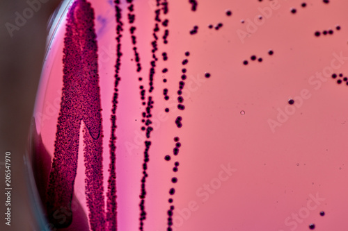 Fényképezés Colony Characteristics of Escherichia coli (E