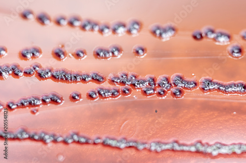 Fényképezés Colony Characteristics of Escherichia coli (E
