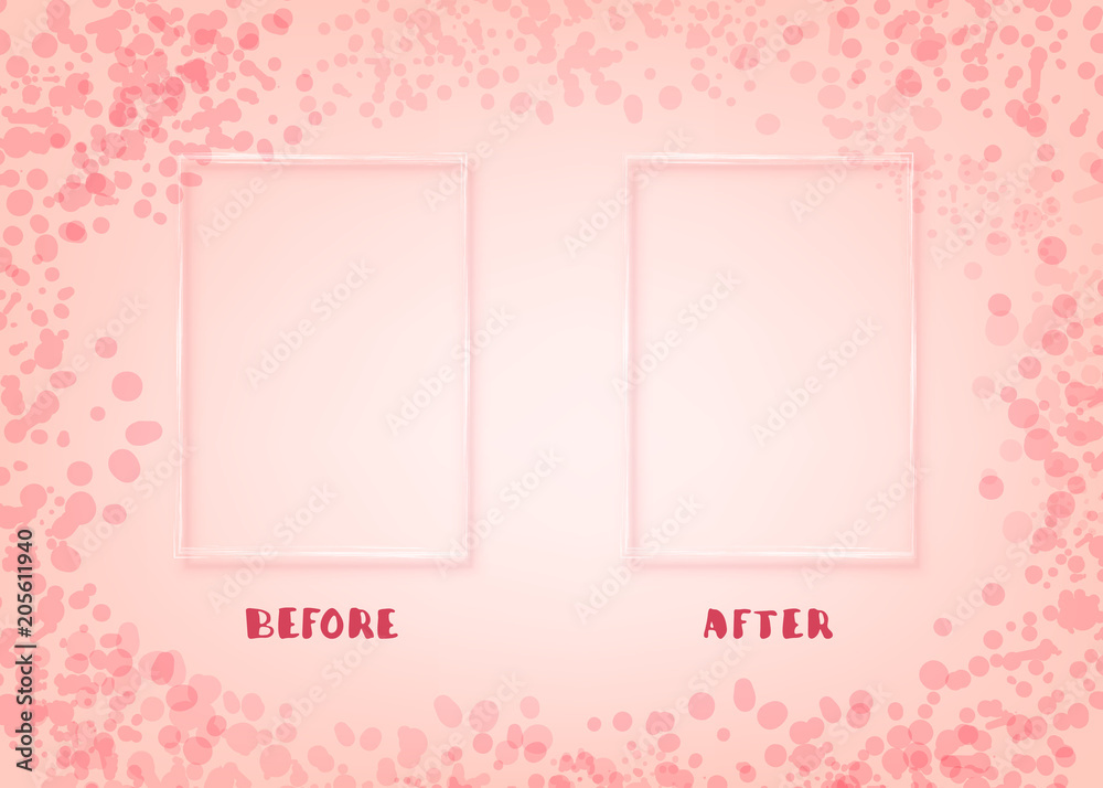 Before and After card. Vector illustration.