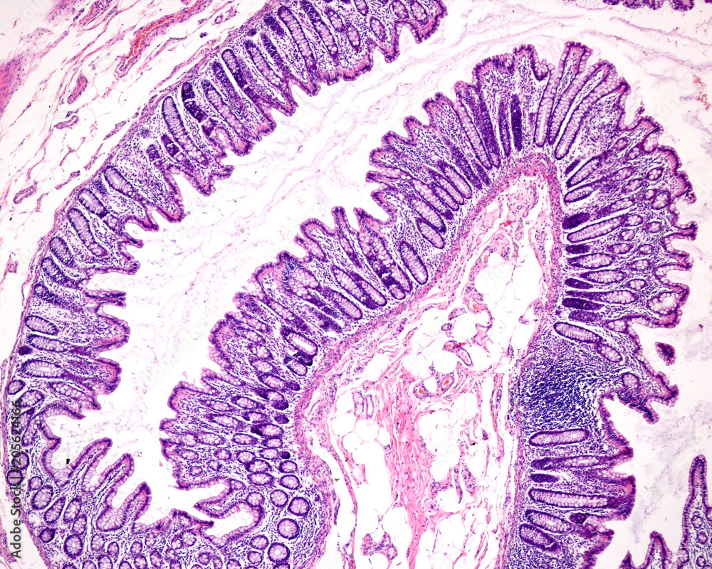 Obraz premium Mucosa of the human colon