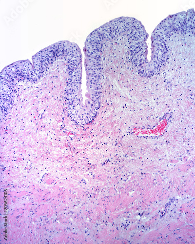 Urinary bladder mucosa photo