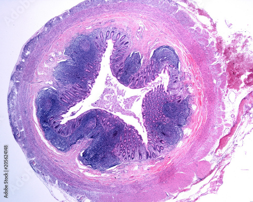 Human vermiform appendix photo