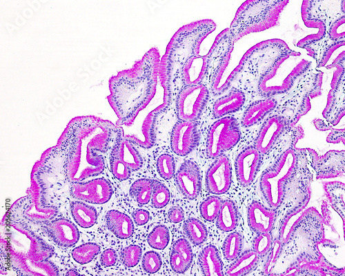 Gastric epithelium. PAS method photo