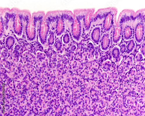 Surface of gastric mucosa