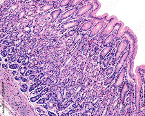 Gastric mucosa photo