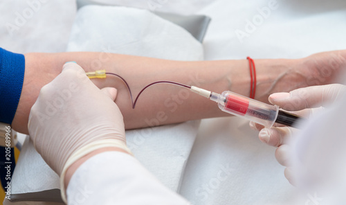 Close up of doctor hands sticking needle into female vein for blood sampling