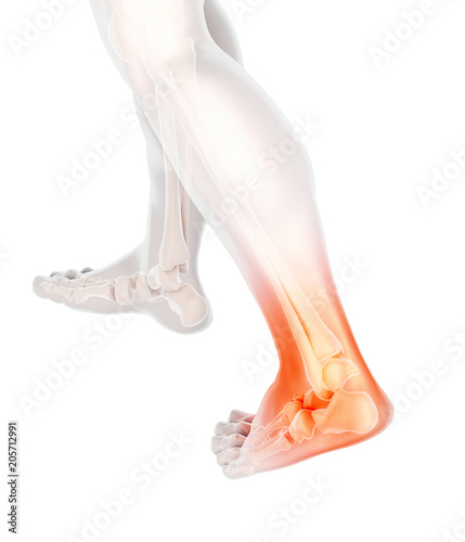 Ankle painful - skeleton x-ray.