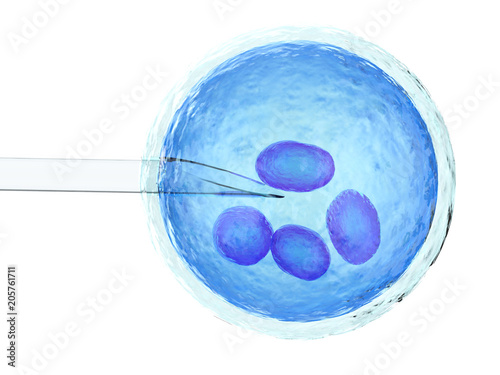 artificial insemination or ivf photo