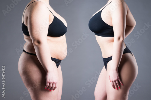 Woman's body before and after weight loss