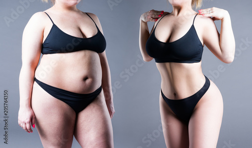 Woman's body before and after weight loss