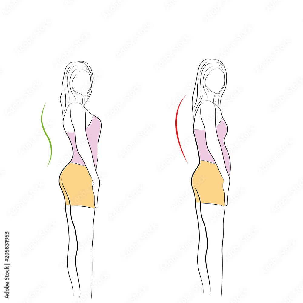 Correct alignment of human body in standing posture for good personality and healthy of spine and bone. Health care and medical illustration Correct alignment of human body in standing posture for good personality and healthy of spine and bone. Health care and medical illustration