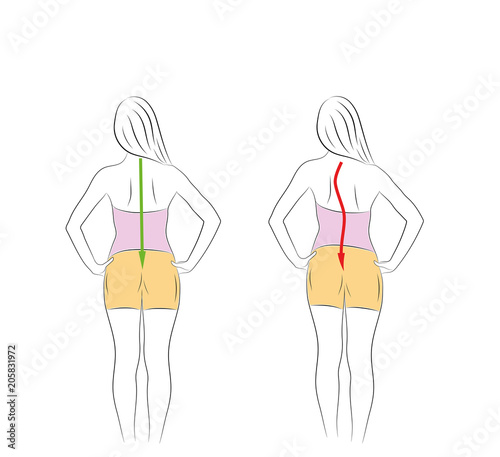 Correct alignment of human body in standing posture for good personality and healthy of spine and bone. Health care and medical illustration