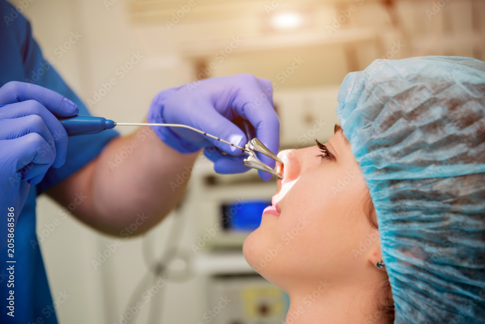 Laser vaporization of nasal concha with coblation technology method. Endoscopic sinus surgery.