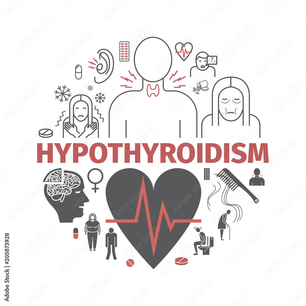 Hyperthyroidism. Symptoms, Treatment. Icons set. Vector signs Hyperthyroidism. Symptoms, Treatment. Icons set. Vector signs