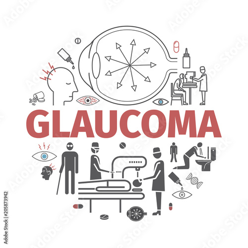 Glaucoma. Symptoms, Treatment. Line icons set. Vector signs for web graphics.