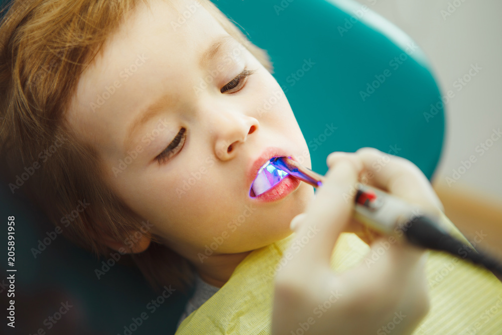 Use of UV fillings child.