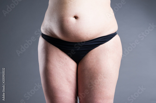 Overweight woman with fat belly, obesity female body